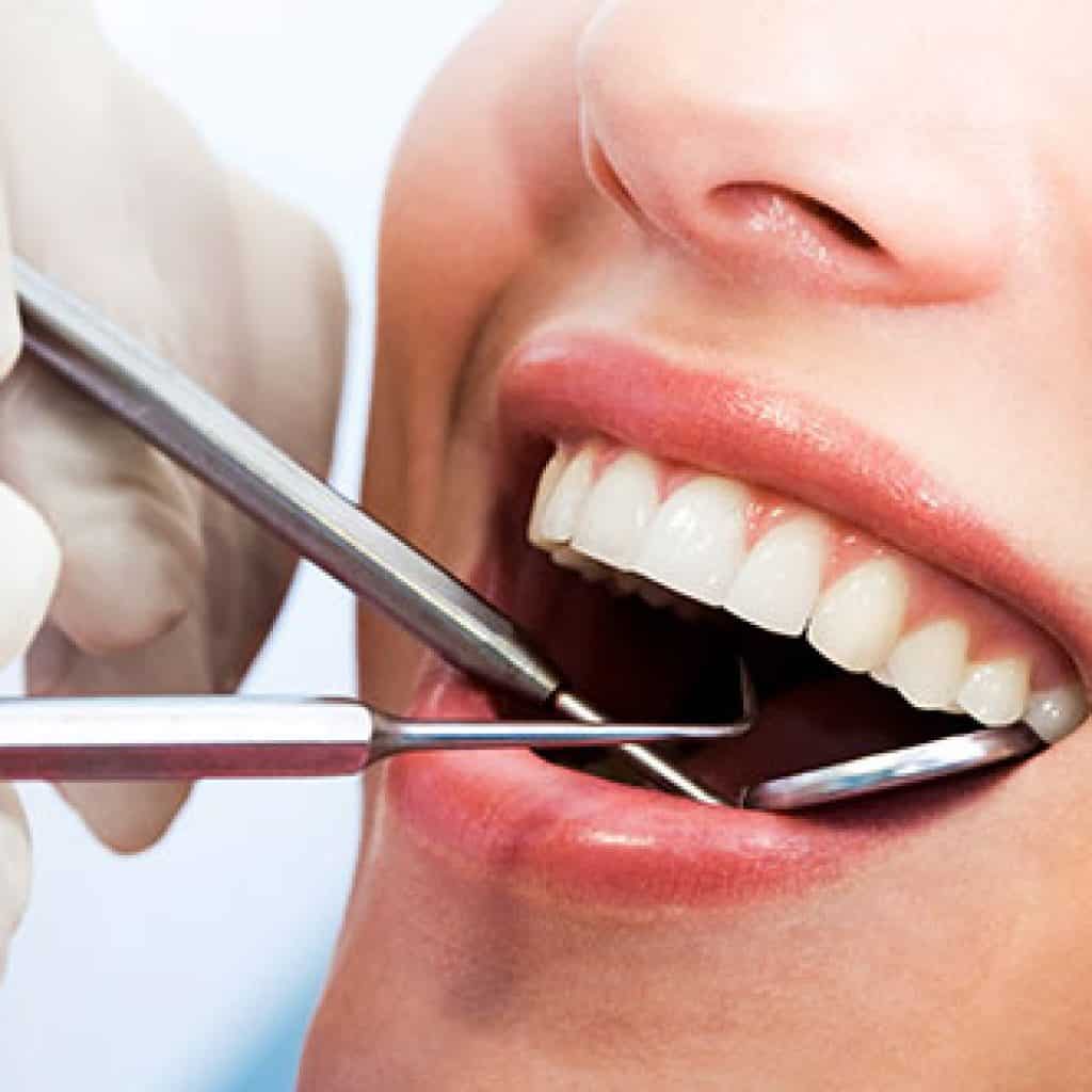 Woman's Mouth undergoing dental examination | Dental Cleanings and Exams in West Liberty, IA, North Liberty, IA and Muscatine, IA | Gentle Family Dentists