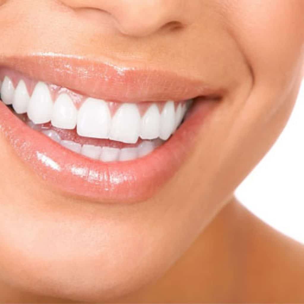 Photo of a Beautiful Teeth | Gum Disease Treatment in West Liberty, IA, North Liberty, IA and Muscatine, IA | Gentle Family Dentists