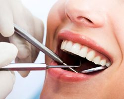 Woman's Mouth undergoing dental examination | Dental Cleanings and Exams in West Liberty, IA, North Liberty, IA and Muscatine, IA | Gentle Family Dentists