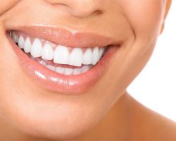 Photo of a Beautiful Teeth | Gum Disease Treatment in West Liberty, IA, North Liberty, IA and Muscatine, IA | Gentle Family Dentists